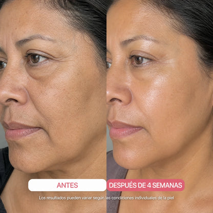 Antes y después 4 semanas
