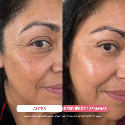 Antes y después 2 semanas