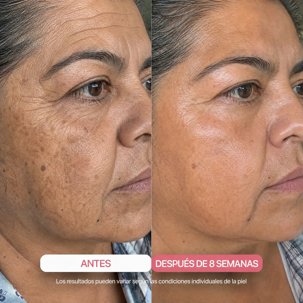 Antes y después 8 semanas