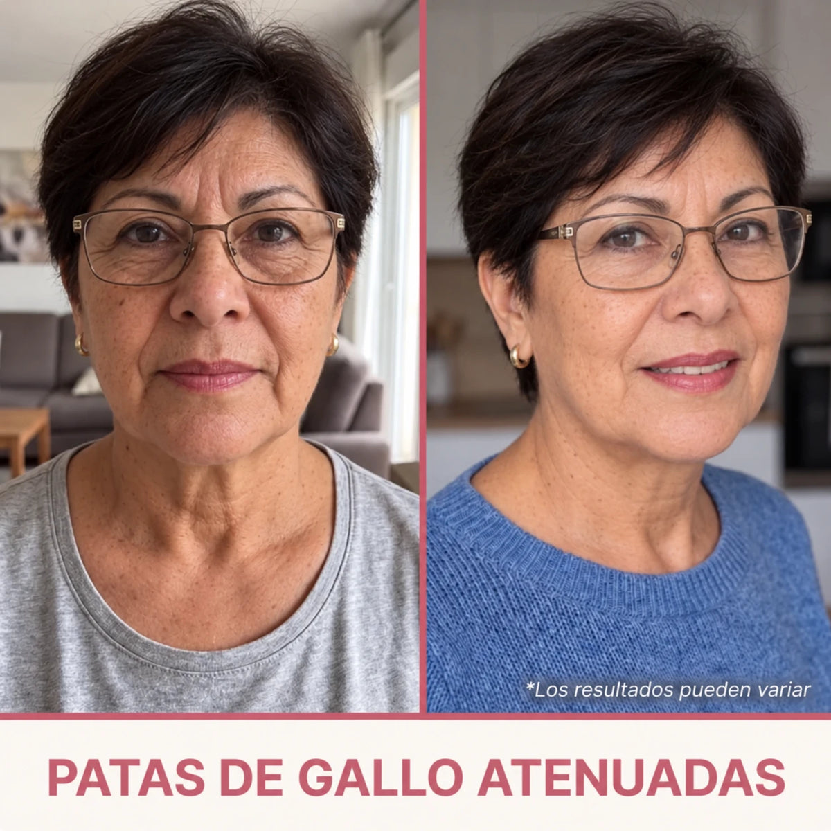 Sérum Coreano Efecto Lifting desde la Primera Aplicación