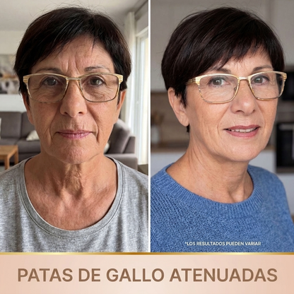 Patas de gallo atenuadas