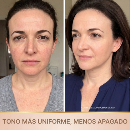 Tono más uniforme, menos apagado