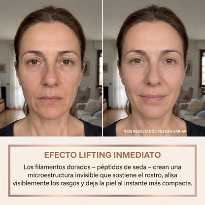 Efecto lifting inmediato antes y después