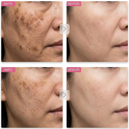Crema Antimanchas Coreana