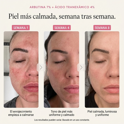 Crema Antimanchas Coreana