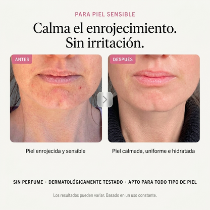 Crema Antimanchas Coreana