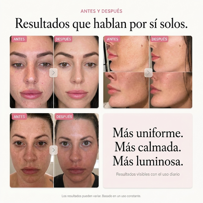 Crema Antimanchas Coreana