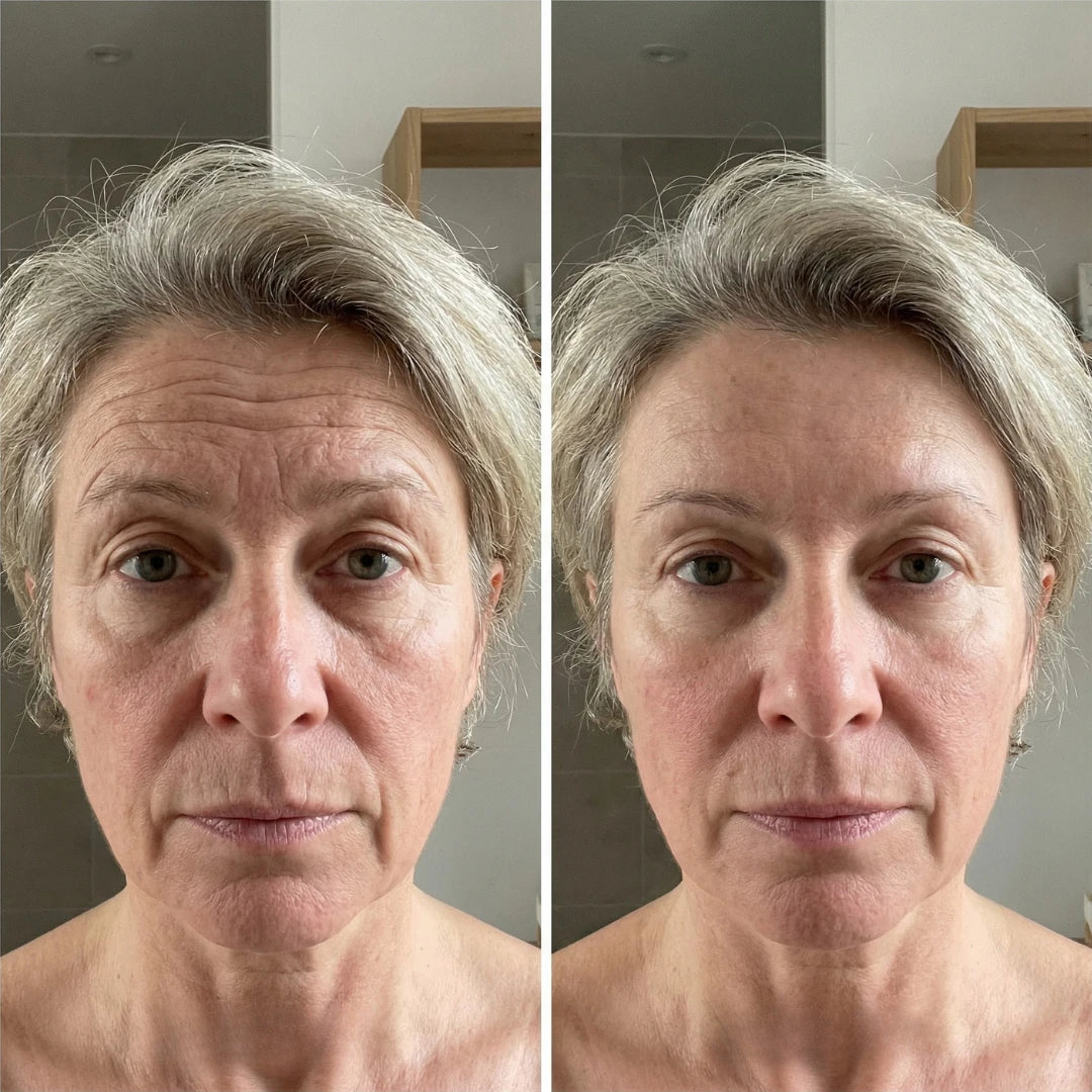 Avelyne Line Smoother - Antes y Después
